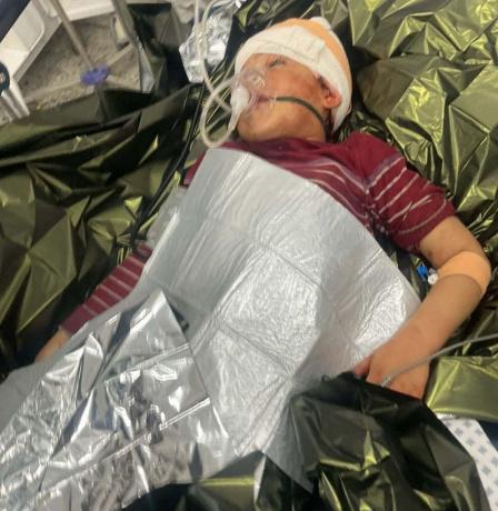 إصابة طفلة برصاص الاحتلال داخل مركز نزوح شمال غزة