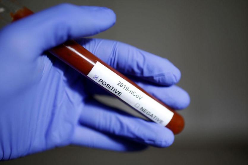 فحوصات عينات لكورونا 