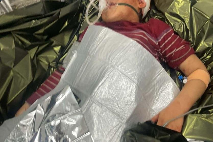 الطفلة المصابة